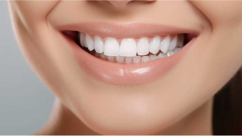 Dental Microabrasion Image